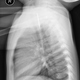 Illustration for article titled The Mystery Of What This Toddler Swallowed Was Quickly Solved